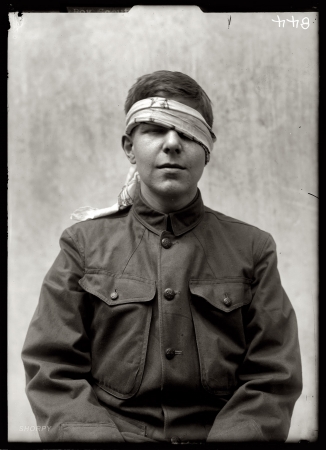 Photo showing: Head Case -- Boy Scout training demonstration, 1912.