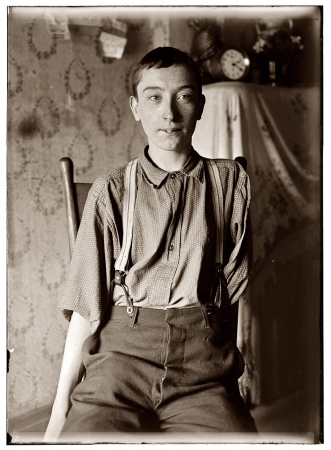 Photo showing: Portrait of Courage -- Harry McShane, 16, had his left arm pulled off near shoulder in machine in Spring Works factory, Cincinnati.