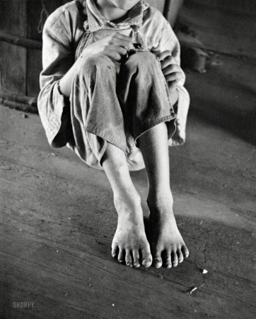 Photo showing: Sharecropped -- Summer 1936. William Tengle, son of cotton sharecropper. Near Moundville, Hale County, Alabama.