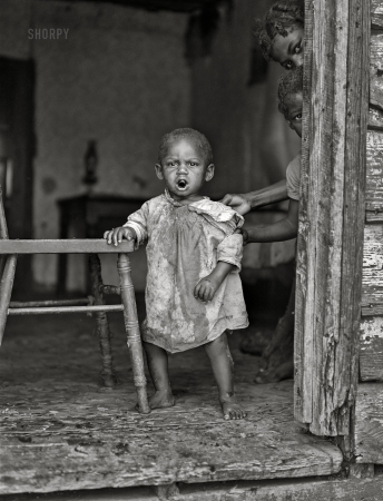 Photo showing: Poor Baby -- September 1940. Saint Mary's County, Maryland. Youngest child of Edward Gant family, FSA borrowers.